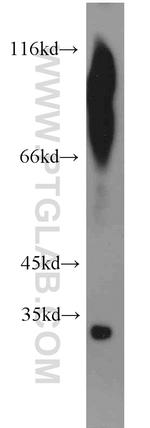 MEST Antibody in Western Blot (WB)