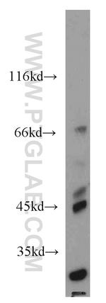 MEST Antibody in Western Blot (WB)