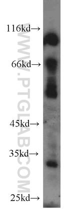 MEST Antibody in Western Blot (WB)