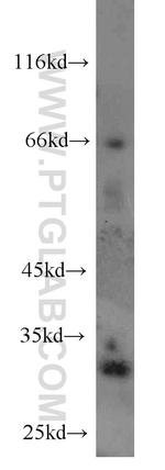 MEST Antibody in Western Blot (WB)