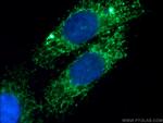 Tim23 Antibody in Immunocytochemistry (ICC/IF)