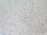 TESC Antibody in Immunohistochemistry (Paraffin) (IHC (P))