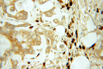 TESC Antibody in Immunohistochemistry (Paraffin) (IHC (P))