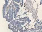 TESC Antibody in Immunohistochemistry (Paraffin) (IHC (P))