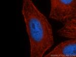 MYH9 Antibody in Immunocytochemistry (ICC/IF)