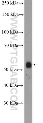 RXRG Antibody in Western Blot (WB)