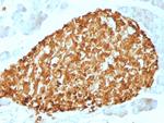 Chromogranin A/CHGA Antibody in Immunohistochemistry (Paraffin) (IHC (P))