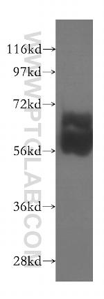 TBX22 Antibody in Western Blot (WB)