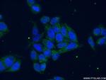 Aconitase 2 Antibody in Immunocytochemistry (ICC/IF)