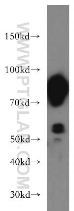 Aconitase 2 Antibody in Western Blot (WB)