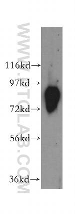 Aconitase 2 Antibody in Western Blot (WB)