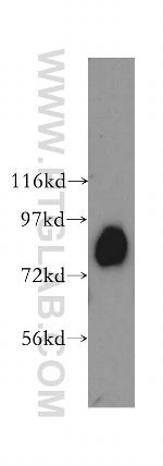 Aconitase 2 Antibody in Western Blot (WB)