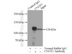 CNOT3 Antibody in Immunoprecipitation (IP)