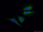 GNAI2 Antibody in Immunocytochemistry (ICC/IF)