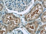 GNAI2 Antibody in Immunohistochemistry (Paraffin) (IHC (P))