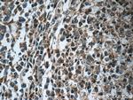 GNAI2 Antibody in Immunohistochemistry (Paraffin) (IHC (P))