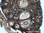 GNAI2 Antibody in Immunohistochemistry (Paraffin) (IHC (P))