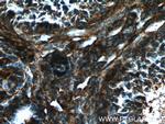 GNAI2 Antibody in Immunohistochemistry (Paraffin) (IHC (P))