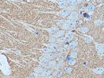 GNAI2 Antibody in Immunohistochemistry (Paraffin) (IHC (P))