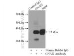 GNAI2 Antibody in Immunoprecipitation (IP)