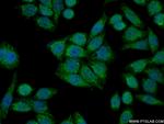 MMAB Antibody in Immunocytochemistry (ICC/IF)