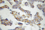 MMAB Antibody in Immunohistochemistry (Paraffin) (IHC (P))