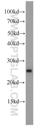 MMAB Antibody in Western Blot (WB)