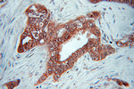 gamma catenin Antibody in Immunohistochemistry (Paraffin) (IHC (P))