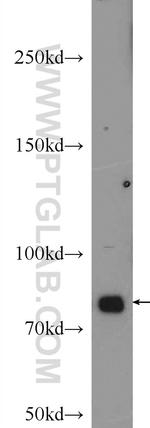 gamma catenin Antibody in Western Blot (WB)