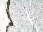 gamma catenin Antibody in Immunohistochemistry (Paraffin) (IHC (P))