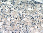 gamma catenin Antibody in Immunohistochemistry (Paraffin) (IHC (P))