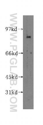 gamma catenin Antibody in Western Blot (WB)