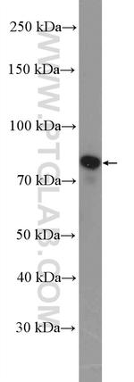 gamma catenin Antibody in Western Blot (WB)