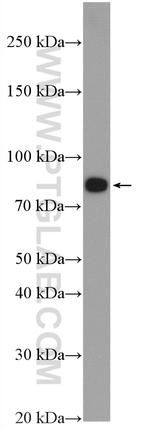 gamma catenin Antibody in Western Blot (WB)