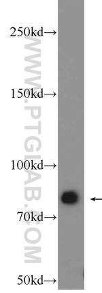 gamma catenin Antibody in Western Blot (WB)