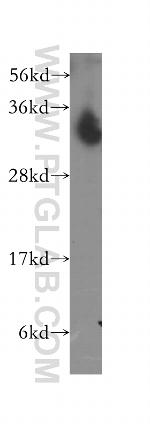 NTHL1 Antibody in Western Blot (WB)