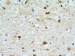 Stathmin 1 Antibody in Immunohistochemistry (Paraffin) (IHC (P))