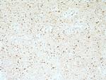 Stathmin 1 Antibody in Immunohistochemistry (Paraffin) (IHC (P))