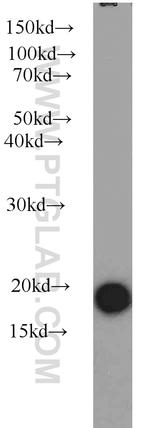 Stathmin 1 Antibody in Western Blot (WB)