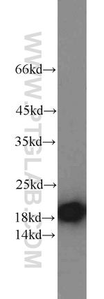 Stathmin 1 Antibody in Western Blot (WB)