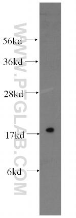 Stathmin 1 Antibody in Western Blot (WB)