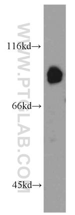 ABCB7 Antibody in Western Blot (WB)