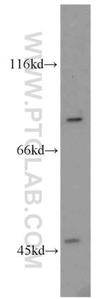 ABCB7 Antibody in Western Blot (WB)