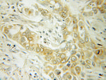 ABCD1 Antibody in Immunohistochemistry (Paraffin) (IHC (P))