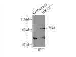 ABCD1 Antibody in Immunoprecipitation (IP)