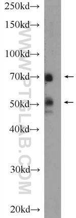 MAPK7 Antibody in Western Blot (WB)