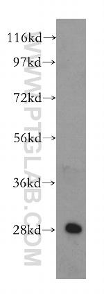 IDI1 Antibody in Western Blot (WB)