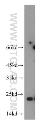 RTN2 Antibody in Western Blot (WB)