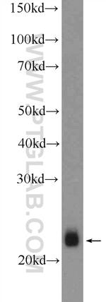 RTN2 Antibody in Western Blot (WB)