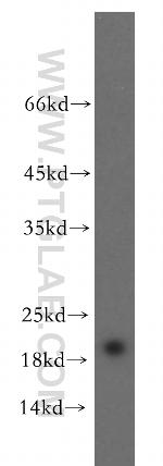 RTN2 Antibody in Western Blot (WB)